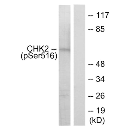 Western Blot - Anti-Chk2 (phospho Ser516) Antibody (A7043) - Antibodies.com