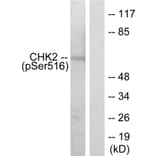 Western Blot - Anti-Chk2 (phospho Ser516) Antibody (A7043) - Antibodies.com