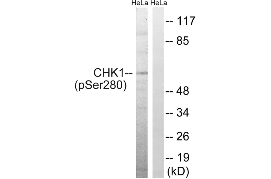Western Blot - Anti-Chk1 (phospho Ser280) Antibody (A7040) - Antibodies.com