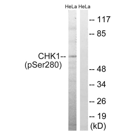 Western Blot - Anti-Chk1 (phospho Ser280) Antibody (A7040) - Antibodies.com