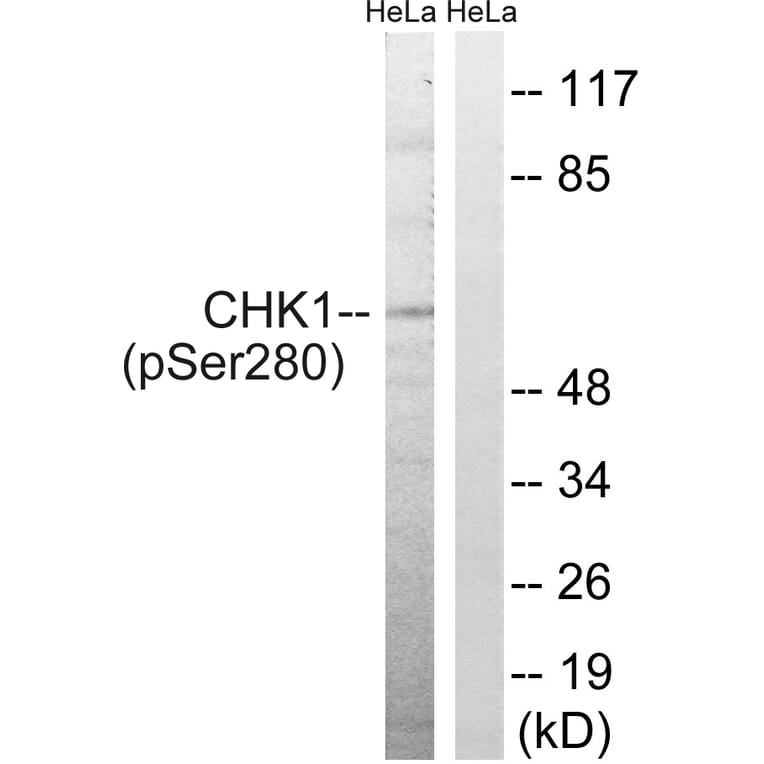 Western Blot - Anti-Chk1 (phospho Ser280) Antibody (A7040) - Antibodies.com