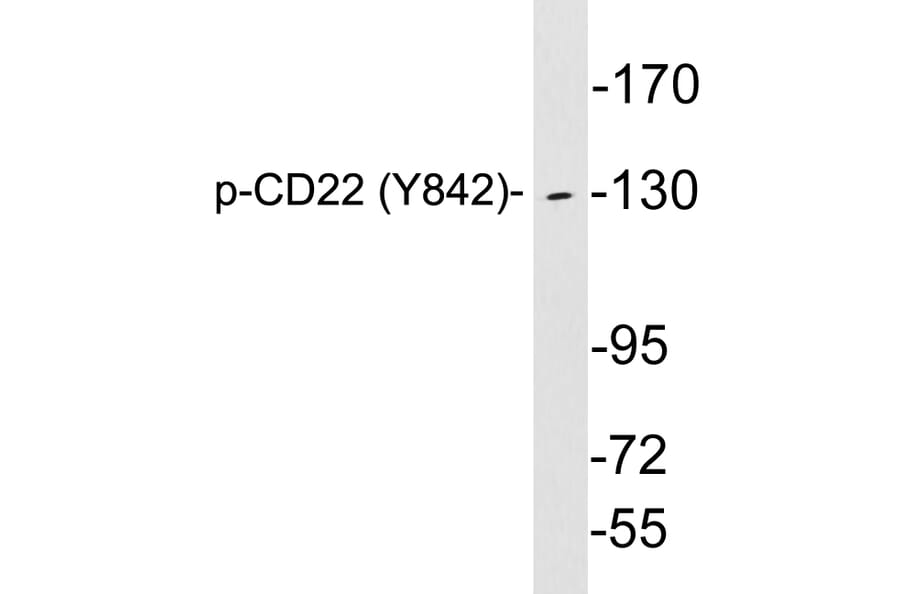 Western Blot - Anti-CD22 (phospho Tyr842) Antibody (P12-1010) - Antibodies.com
