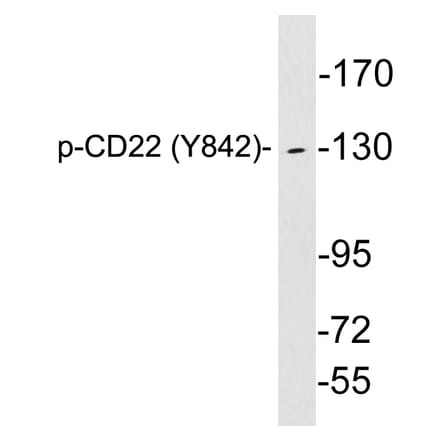 Western Blot - Anti-CD22 (phospho Tyr842) Antibody (P12-1010) - Antibodies.com