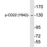 Western Blot - Anti-CD22 (phospho Tyr842) Antibody (P12-1010) - Antibodies.com