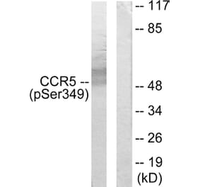 Western Blot - Anti-CCR5 (phospho Ser349) Antibody (A0062) - Antibodies.com