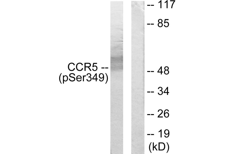 Western Blot - Anti-CCR5 (phospho Ser349) Antibody (A0062) - Antibodies.com