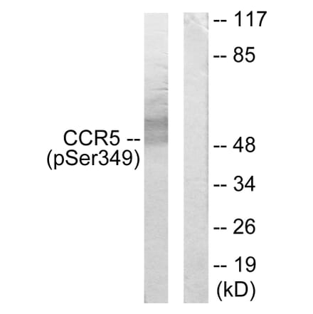 Western Blot - Anti-CCR5 (phospho Ser349) Antibody (A0062) - Antibodies.com