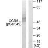 Western Blot - Anti-CCR5 (phospho Ser349) Antibody (A0062) - Antibodies.com