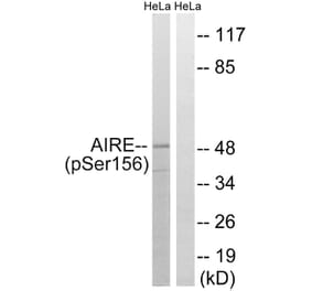 Western Blot - Anti-AIRE (phospho Ser156) Antibody (A8286) - Antibodies.com