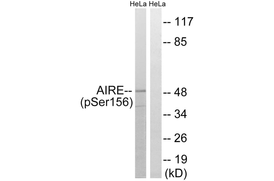 Western Blot - Anti-AIRE (phospho Ser156) Antibody (A8286) - Antibodies.com