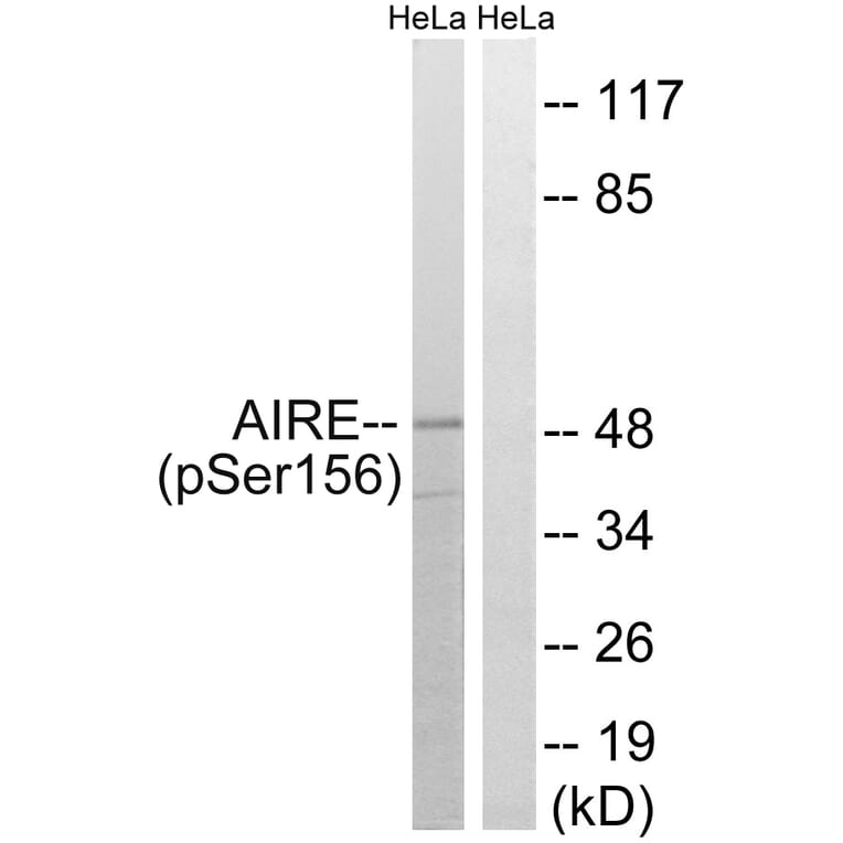 Western Blot - Anti-AIRE (phospho Ser156) Antibody (A8286) - Antibodies.com