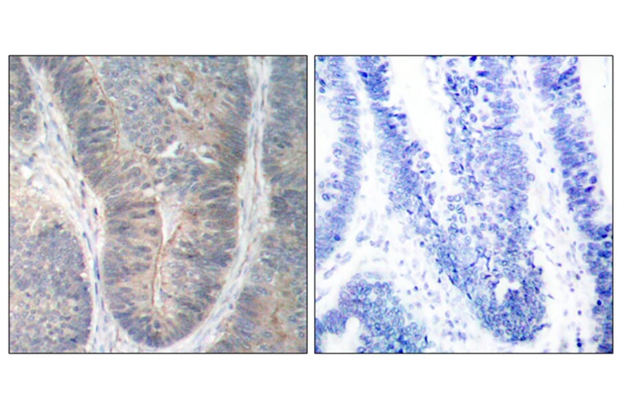 Immunohistochemistry - Anti-PKR (phospho Thr451) Antibody (A7199) - Antibodies.com