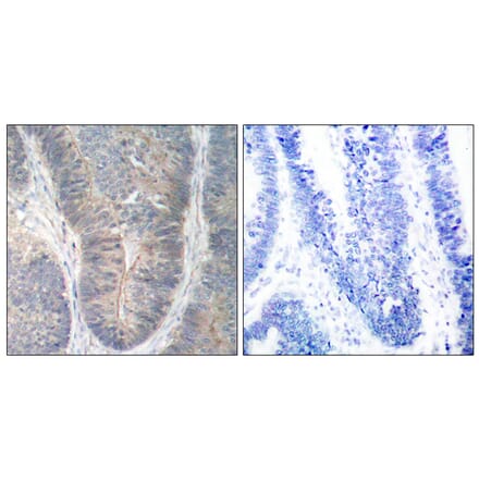 Immunohistochemistry - Anti-PKR (phospho Thr451) Antibody (A7199) - Antibodies.com