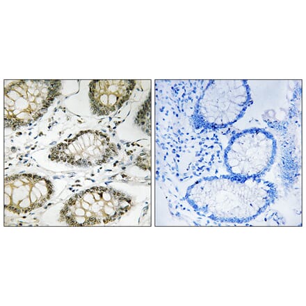 Immunohistochemistry - Anti-ATR (phospho Ser428) Antibody (A8270) - Antibodies.com