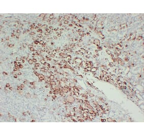 Immunohistochemistry - Anti-Thyroid Peroxidase Antibody (V0133) - Antibodies.com