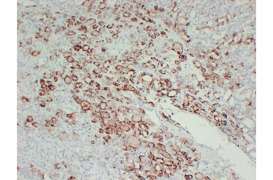Immunohistochemistry - Anti-Thyroid Peroxidase Antibody (V0133) - Antibodies.com
