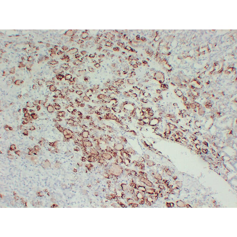 Immunohistochemistry - Anti-Thyroid Peroxidase Antibody (V0133) - Antibodies.com