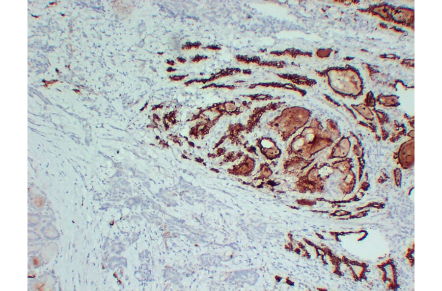 Immunohistochemistry - Anti-Thyroid Peroxidase Antibody (V0133) - Antibodies.com