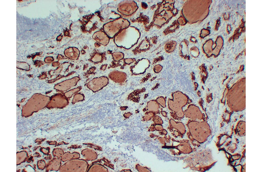 Immunohistochemistry - Anti-Thyroid Peroxidase Antibody (V0133) - Antibodies.com
