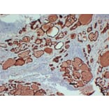 Immunohistochemistry - Anti-Thyroid Peroxidase Antibody (V0133) - Antibodies.com