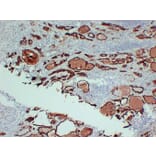 Immunohistochemistry - Anti-Thyroid Peroxidase Antibody (V0133) - Antibodies.com