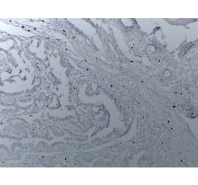 Immunohistochemistry - Anti-Mast Cell Tryptase Antibody (V0092) - Antibodies.com