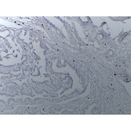 Immunohistochemistry - Anti-Mast Cell Tryptase Antibody (V0092) - Antibodies.com