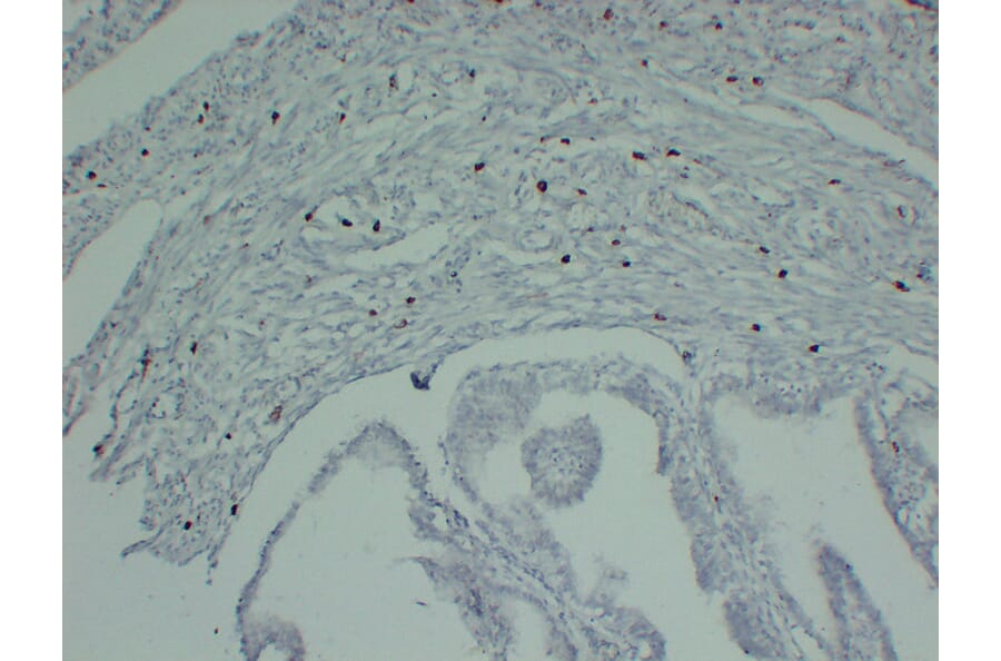 Immunohistochemistry - Anti-Mast Cell Tryptase Antibody (V0092) - Antibodies.com