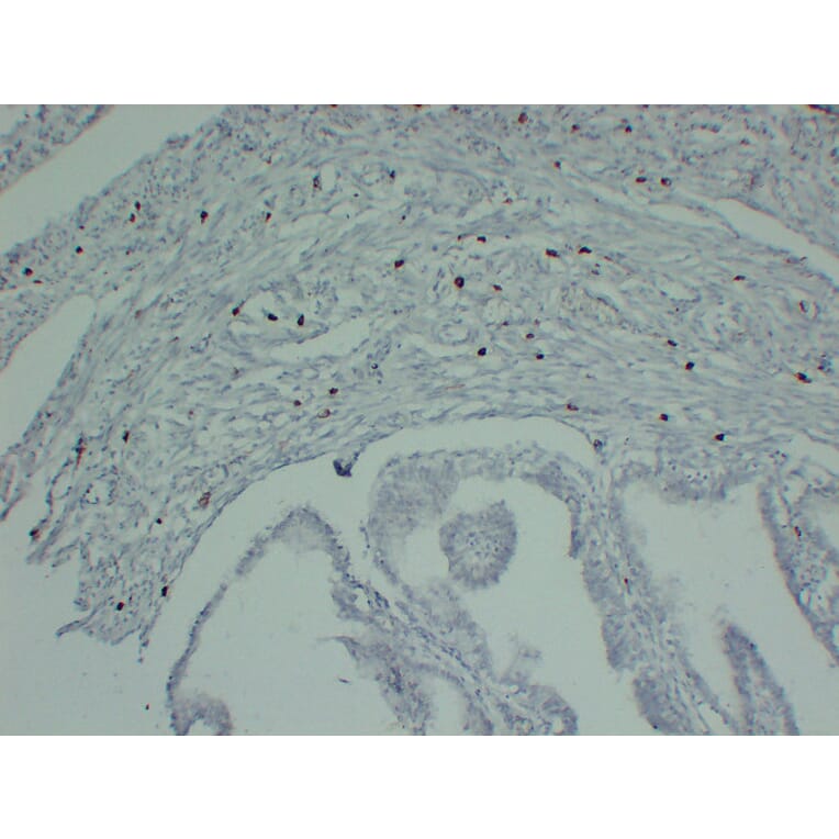 Immunohistochemistry - Anti-Mast Cell Tryptase Antibody (V0092) - Antibodies.com