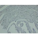 Immunohistochemistry - Anti-Mast Cell Tryptase Antibody (V0092) - Antibodies.com