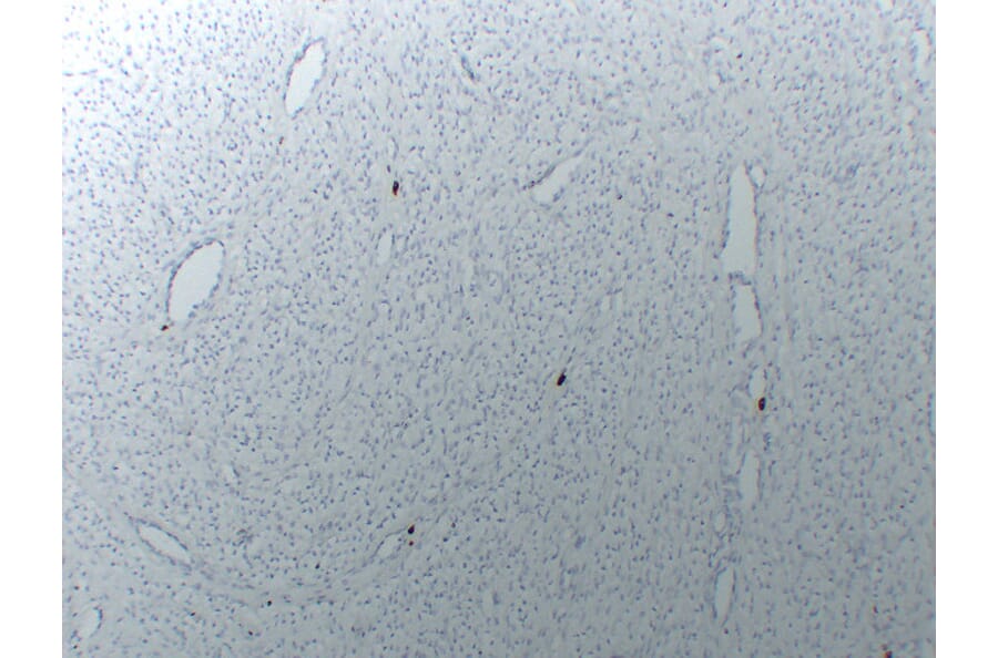 Immunohistochemistry - Anti-Mast Cell Tryptase Antibody (V0092) - Antibodies.com
