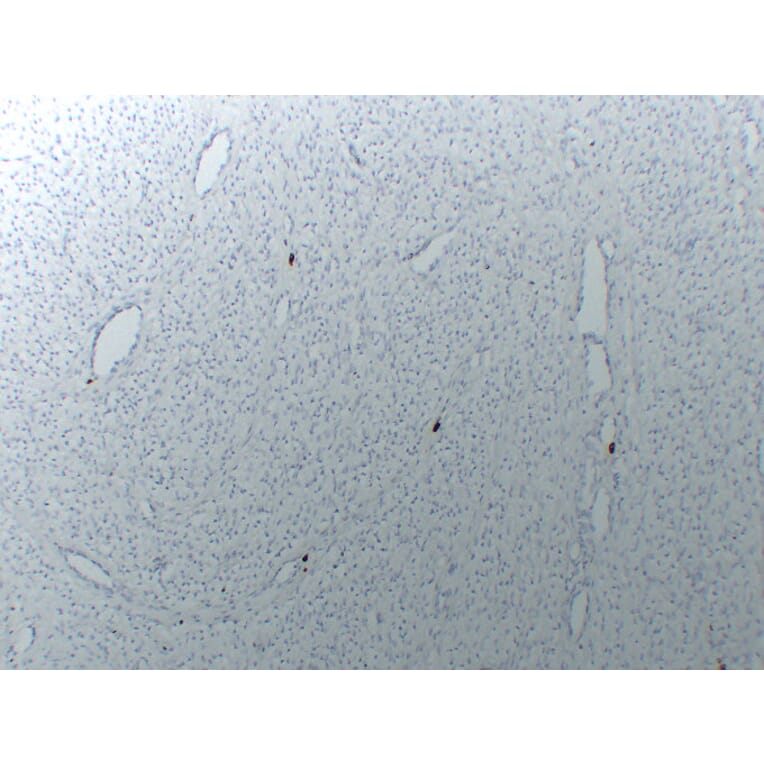 Immunohistochemistry - Anti-Mast Cell Tryptase Antibody (V0092) - Antibodies.com