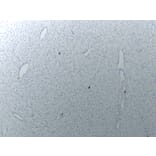 Immunohistochemistry - Anti-Mast Cell Tryptase Antibody (V0092) - Antibodies.com