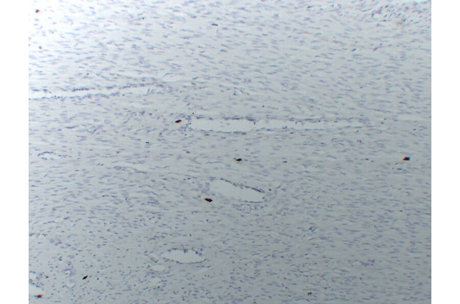 Immunohistochemistry - Anti-Mast Cell Tryptase Antibody (V0092) - Antibodies.com