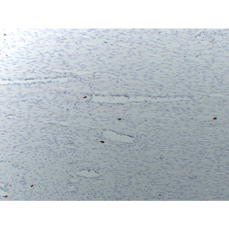 Immunohistochemistry - Anti-Mast Cell Tryptase Antibody (V0092) - Antibodies.com