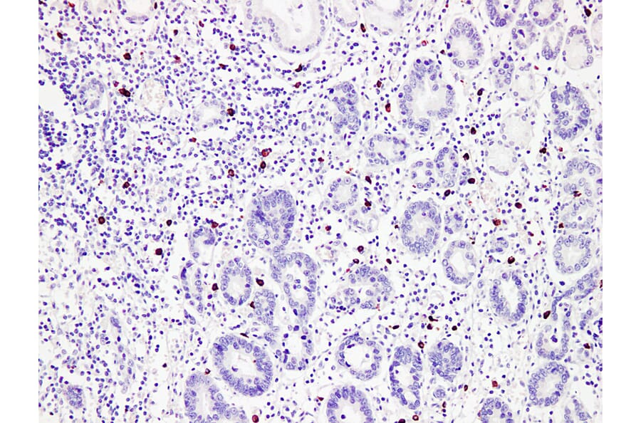Immunohistochemistry - Anti-Mast Cell Tryptase Antibody (V0092) - Antibodies.com