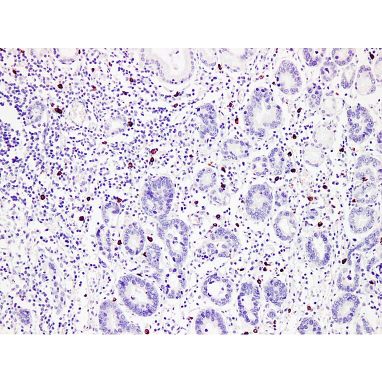 Immunohistochemistry - Anti-Mast Cell Tryptase Antibody (V0092) - Antibodies.com