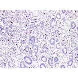 Immunohistochemistry - Anti-Mast Cell Tryptase Antibody (V0092) - Antibodies.com