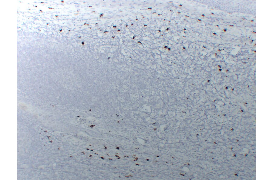 Immunohistochemistry - Anti-Mast Cell Tryptase Antibody (V0092) - Antibodies.com