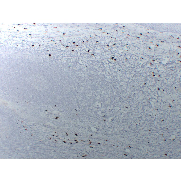 Immunohistochemistry - Anti-Mast Cell Tryptase Antibody (V0092) - Antibodies.com