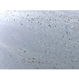 Immunohistochemistry - Anti-Mast Cell Tryptase Antibody (V0092) - Antibodies.com