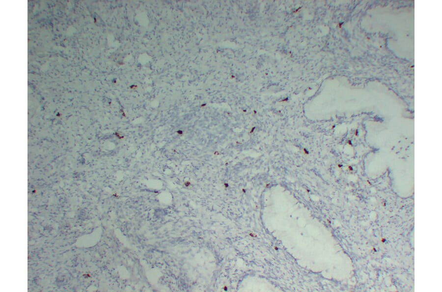 Immunohistochemistry - Anti-Mast Cell Tryptase Antibody (V0092) - Antibodies.com