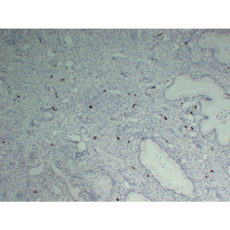 Immunohistochemistry - Anti-Mast Cell Tryptase Antibody (V0092) - Antibodies.com