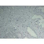 Immunohistochemistry - Anti-Mast Cell Tryptase Antibody (V0092) - Antibodies.com