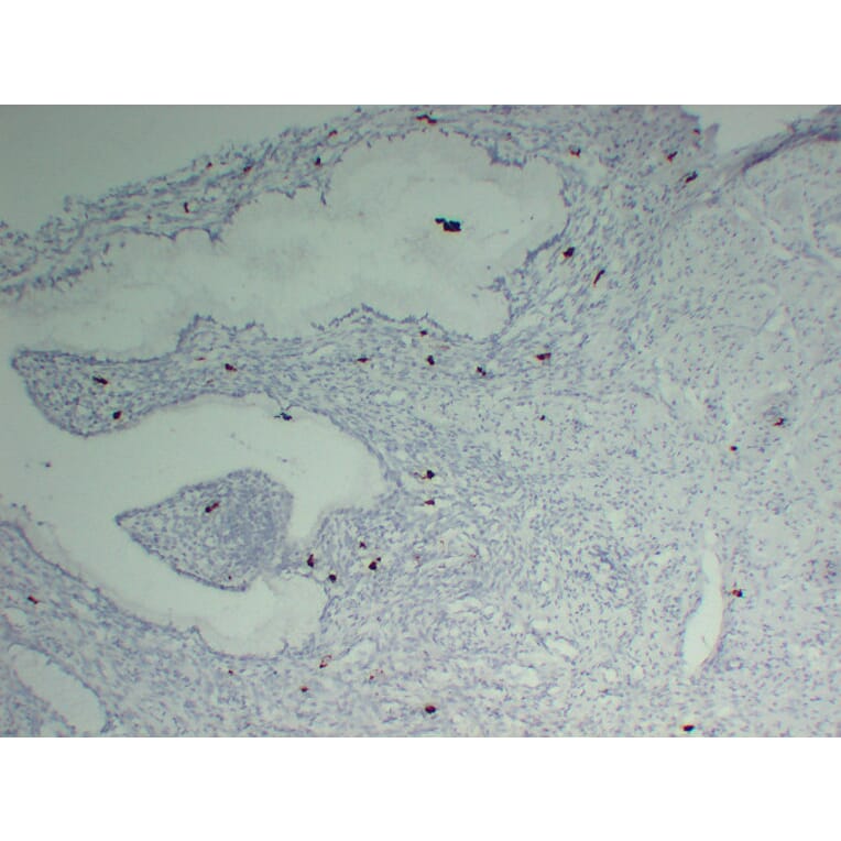 Immunohistochemistry - Anti-Mast Cell Tryptase Antibody (V0092) - Antibodies.com