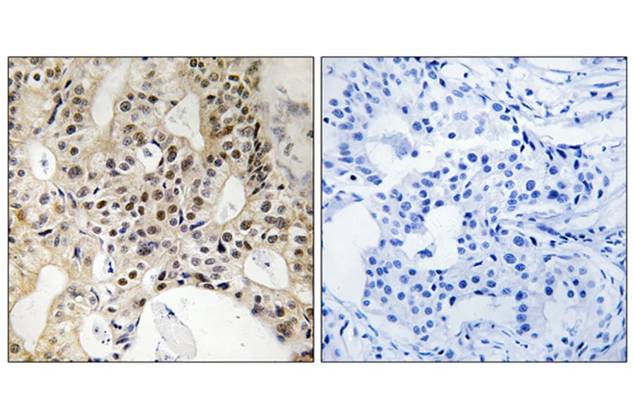 Immunohistochemistry - Anti-LATS1 + LATS2 Antibody (B8125) - Antibodies.com