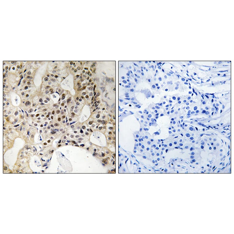 Immunohistochemistry - Anti-LATS1 + LATS2 Antibody (B8125) - Antibodies.com