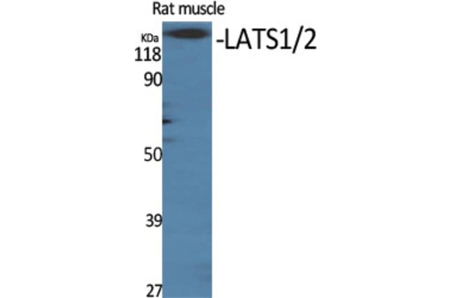 Western Blot - Anti-LATS1 + LATS2 Antibody (B8125) - Antibodies.com