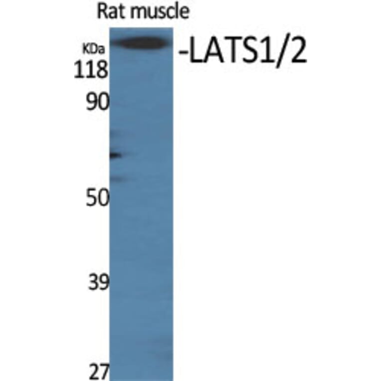 Western Blot - Anti-LATS1 + LATS2 Antibody (B8125) - Antibodies.com