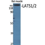 Western Blot - Anti-LATS1 + LATS2 Antibody (B8125) - Antibodies.com